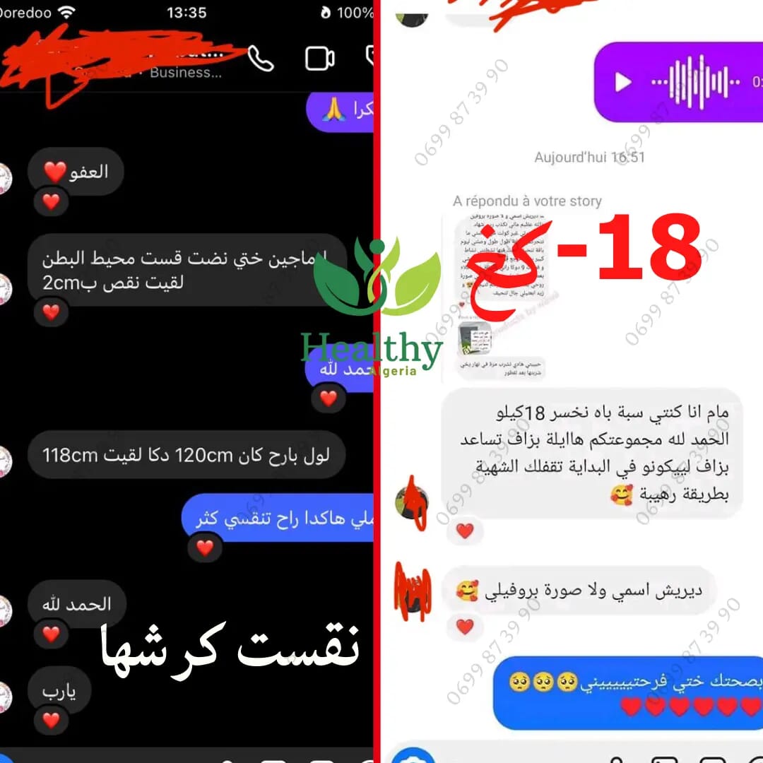 فقدان الوزن