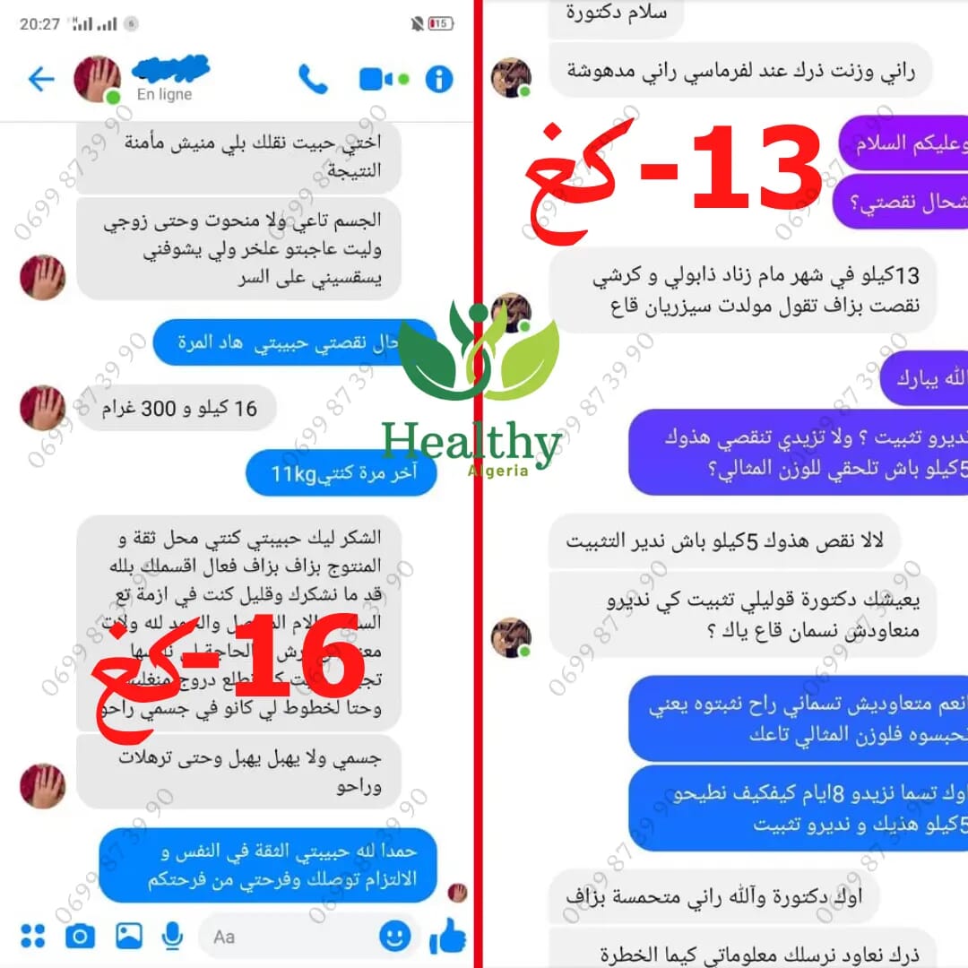 فقدان الوزن